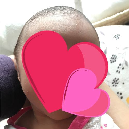 【体験談】髪の毛の薄い赤ちゃんはいつから結べるようになる？